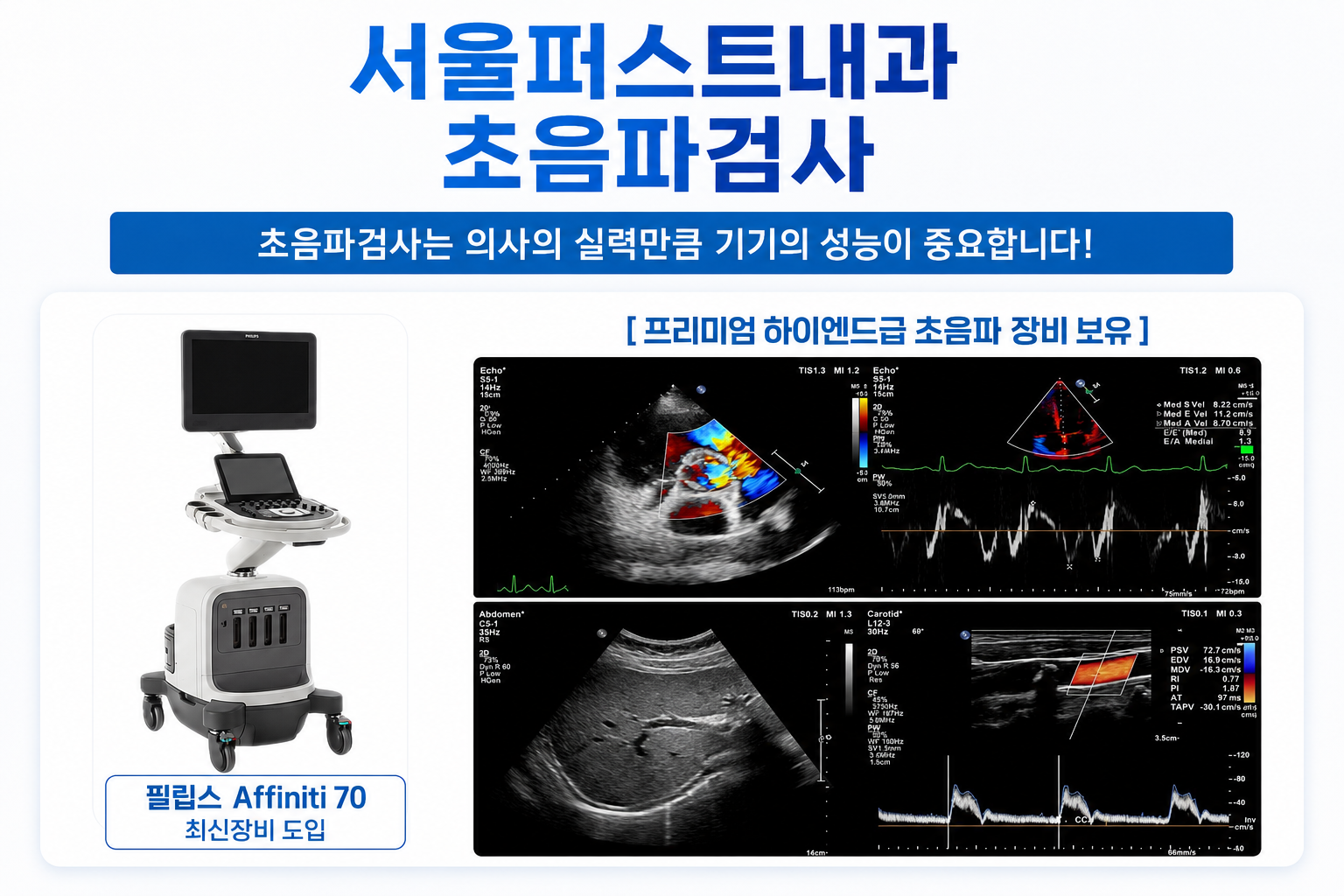 서울퍼스트내과 초음파 검사 — 필립스 Affiniti 70 프리미엄 하이엔드급 장비